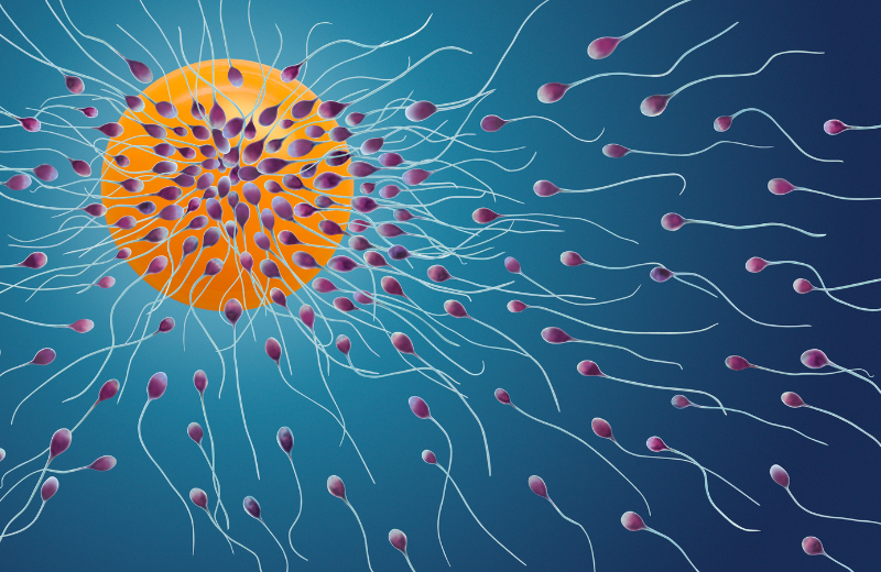 Surgical Sperm Retrieval